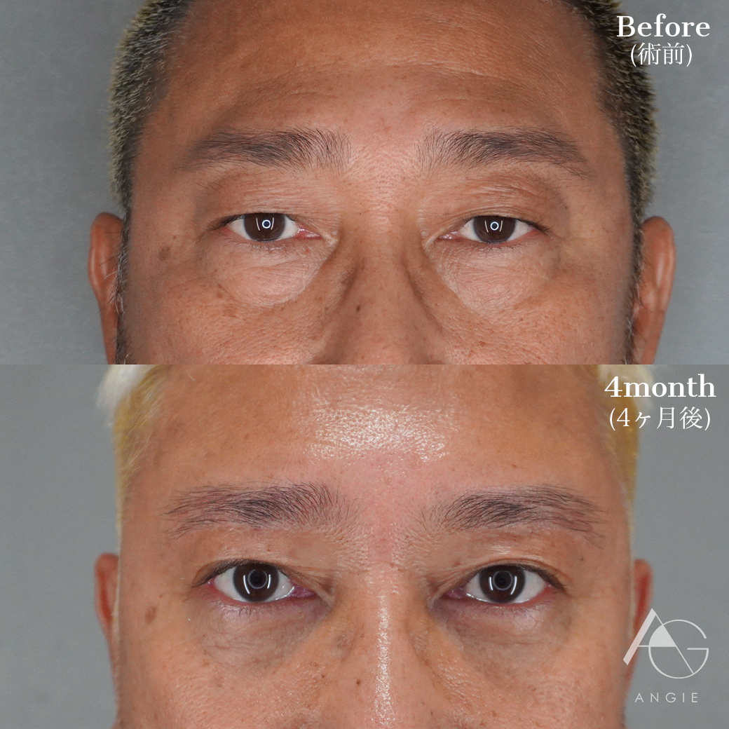 Angie 美容外科 美容皮膚科 アートメイク 渋谷の美容クリニック