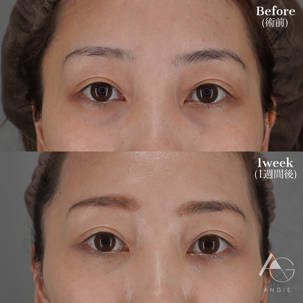 Angie 美容外科 美容皮膚科 アートメイク 渋谷の美容クリニック